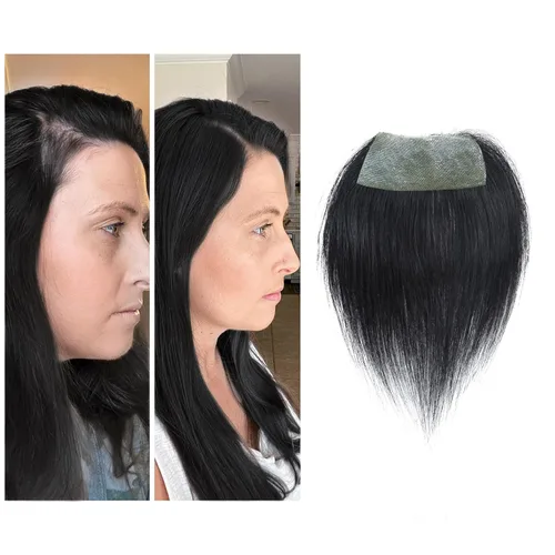 Miniatura 27 de Reemplazo de cabello humano con cicatrices, quemaduras accidentales sin vello para hombres y mujeres, pérdida de línea de cabello, cinta recta