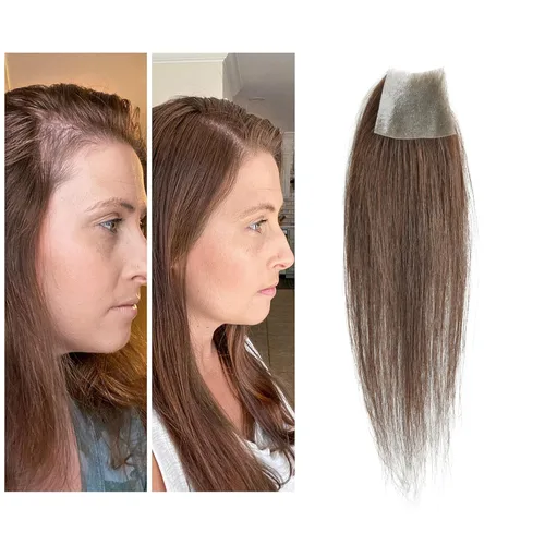 Miniatura 29 de Reemplazo de cabello humano con cicatrices, quemaduras accidentales sin vello para hombres y mujeres, pérdida de línea de cabello, cinta recta