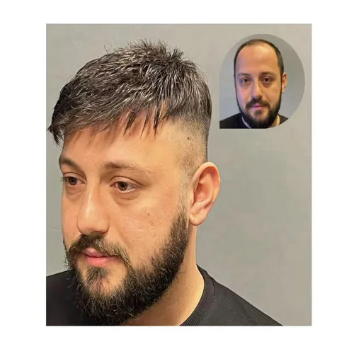 Miniatura 74 de Toupee - Sistema de reemplazo de cabello humano para hombre, 0.004 in, inyectado, piel de polietileno, piezas de pelo para hombre, 6 x 8 pulgadas