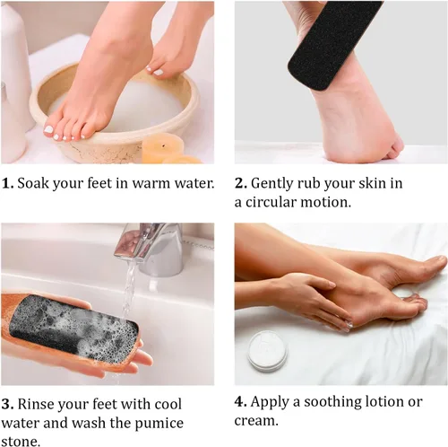 Miniatura 4 de Lima de pies con mango de piedra pómez para piel seca y muerta, crema de pies para pies y tacones secos agrietados, hidratante natural, tratamiento