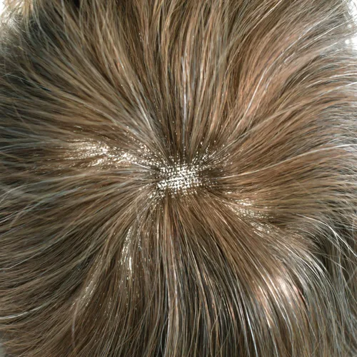 Miniatura 4 de Toupee para hombres Piezas de cabello humano real, encaje francés completo para hombres, pieza de cabello, nudos blanqueados, línea capilar natural
