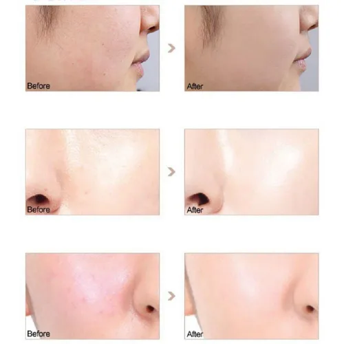 Miniatura 6 de PHOERA - Paquete de 2 imprimaciones para maquillaje facial, encogimiento de poros, arrugas que eliminan las líneas finas, hidratación, Clean