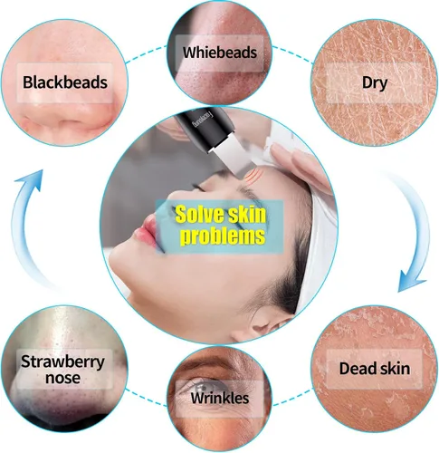 Miniatura 5 de Limpiador facial de piel con pulverizador, pulverizador mejorado, extractor de puntos negros para limpieza profunda e hidratante en aerosol