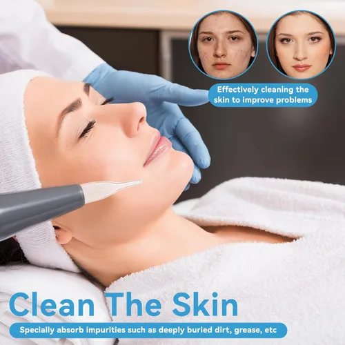 Miniatura 3 de Kit de tubo de vidrio al vacío, 3 piezas, eliminación de puntos negros, aspirador de poros de succión facial para limpiador facial, máquina