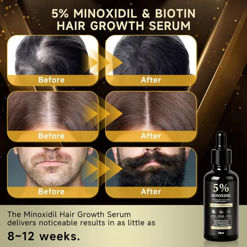 Miniatura 2 de Suero de biotina para el crecimiento del cabello de minoxidil al 5% para hombres y mujeres, solución tópica capilar de minoxidil para el crecimiento