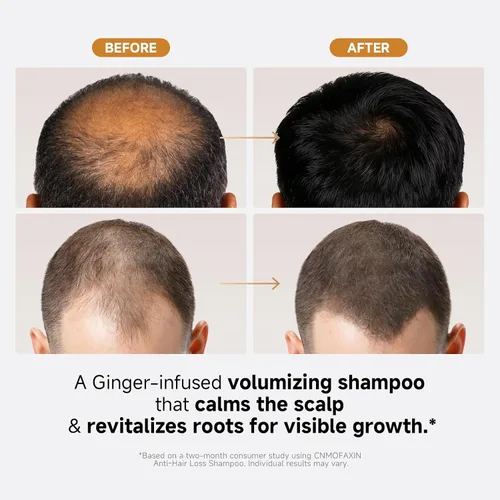 Miniatura 4 de Champú anticaída de cabello, champú nutritivo para el crecimiento del cabello para hombres y mujeres, tratamiento voluminizador para el crecimiento