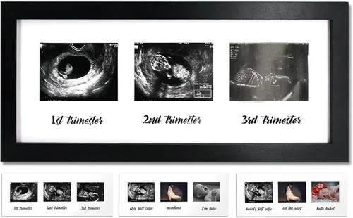 IHEIPYE Marco de Embarazo de Triple Sonograma – Marco de Fotos de Ultrasonido de Bebé con Historia para Futuros Padres, Marco de Baby Shower, Marco