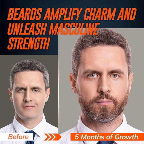 Miniatura 3 de RootStim 5% Minoxidil Beard Growth Serum for Men: 2-Pack Minoxidil Hair Regrowth Spray with Biotin & Rice Water - Extra Strength Beard Oil for
