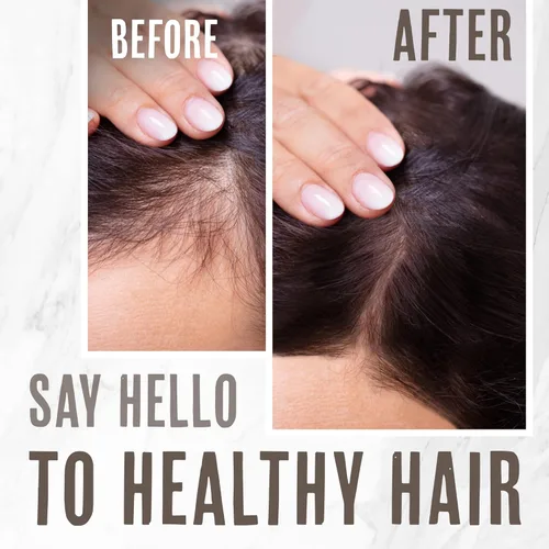 Miniatura 5 de MSM Barra de champú + barra de acondicionador de cabello hialurónico, champú y acondicionador de barra sólida para el crecimiento del cabello, sin