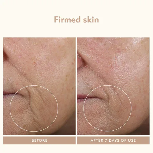 Miniatura 3 de SHANI DARDEN SKIN CARE - Varita para esculpir el rostro, dispositivo de reafirmación y apriete del cuello, dispositivo de ondas de sonido