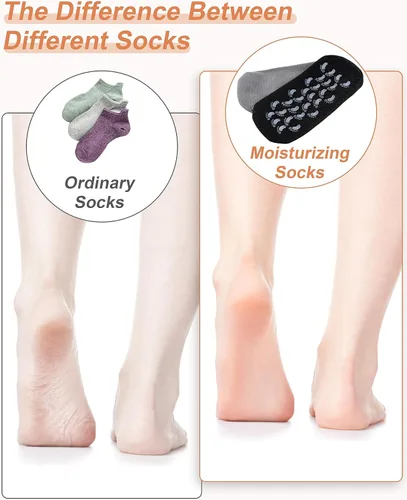 Miniatura 5 de Calcetines hidratantes, 2 pares de calcetines de loción para pies secos y agrietados para mujeres, calcetines hidratantes de pies, calcetines