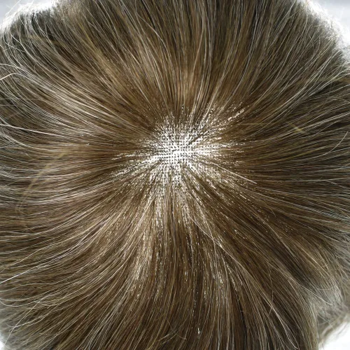 Miniatura 213 de Sistema de repuesto de cabello humano europeo con encaje frontal suizo para hombre, tupé para hombre, pieza de cabello, nudo blanqueado, línea #17