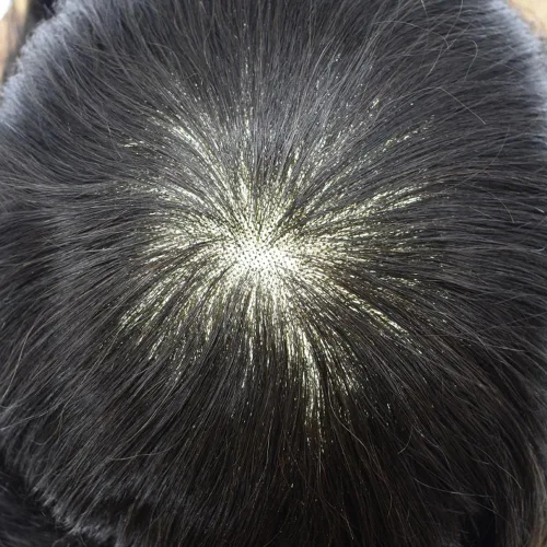 Miniatura 6 de Toupee - Pieza de cabello humano real, sistema de reemplazo de encaje suizo suave para hombre, pieza de pelo tipo tupé, protesis capilar para hombre