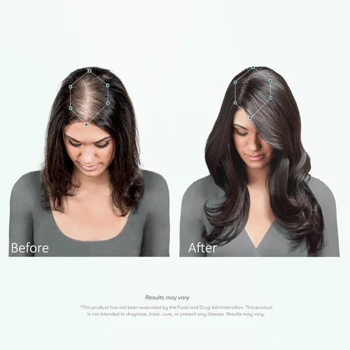 Miniatura 5 de Tricomax Suplemento para el crecimiento del cabello, apoya el cabello más grueso, más lleno y reduce la caída, ingredientes clínicamente estudiados