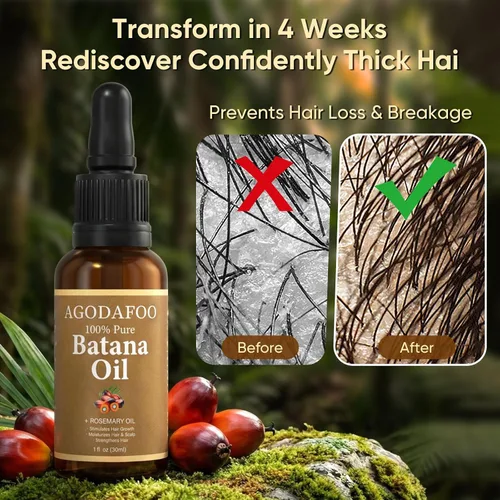 Miniatura 4 de Aceite de batana para el crecimiento del cabello, 100% puro y natural, reduce la pérdida de cabello y desintoxica tu cuero cabelludo, nutre el cuero