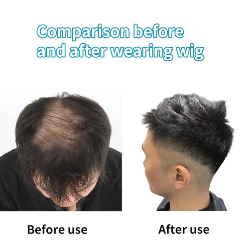 Miniatura 6 de WeKen Tupé corto para hombre – Peluca con clip en extensiones de corona – Pieza para hombre para cubrir la pérdida blanca – Uso diario