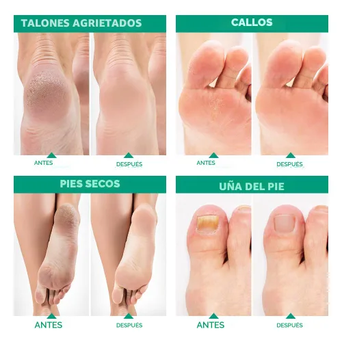 Miniatura 6 de Aceite de árbol de té para pies con sal de Epsom, fabricado en Estados Unidos, para la salud de las uñas de los pies, pies de atletas, olor