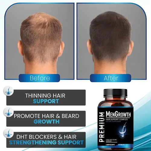 Miniatura 8 de NutraPro Vitaminas para el crecimiento del cabello para hombres, suplemento anti pérdida de cabello, píldoras de crecimiento del cabello y barba