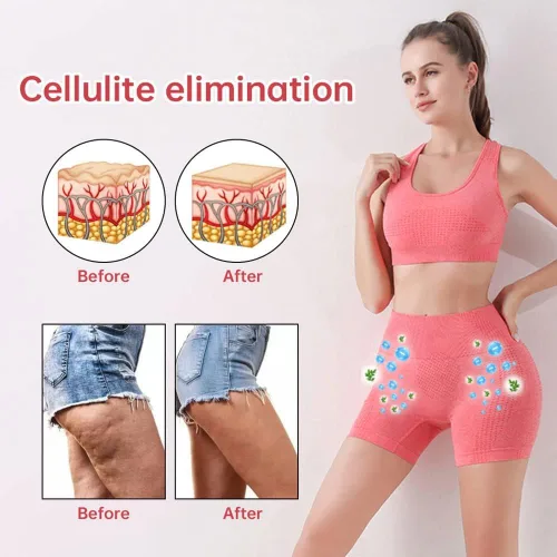 Miniatura 4 de Mixdameny Shapermov - Pantalones cortos moldeadores de iones, tela transpirable y cómoda, pantalones cortos con levantamiento de glúteos para mujer