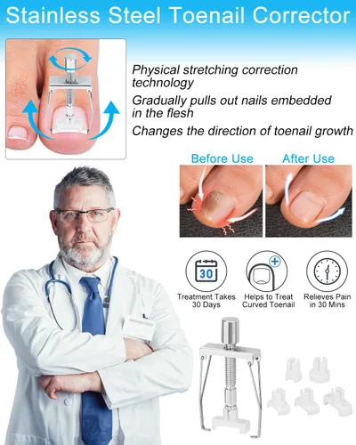 Miniatura 3 de Kit de eliminación de uñas encarnadas, tratamiento de uñas encarnadas, herramientas correctoras de uñas encarnadas vienen con soportes para uñas