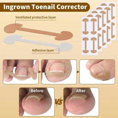 Miniatura 6 de Juego de corrector de uñas encarnadas con tiras correctoras y lima sin dolor, kit profesional de eliminación de uñas encarnadas con herramienta