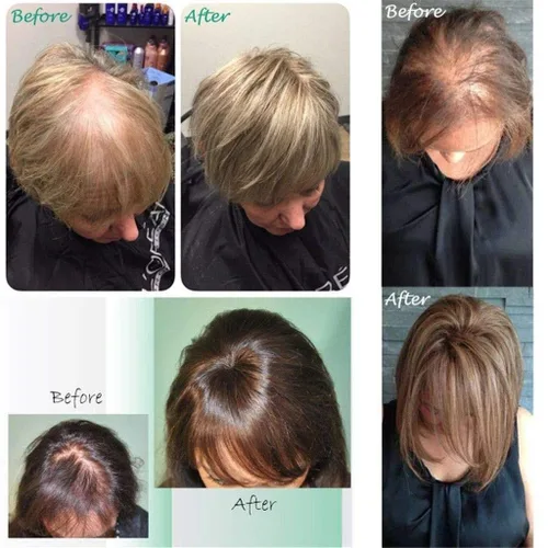 Miniatura 3 de Extensiones de cabello humano Remy atado a mano para mujeres con parte izquierda, 3 x 4 pulgadas, base de seda mono, 10 pulgadas, rubio 613# 613#