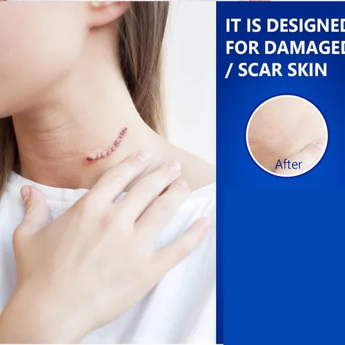 Miniatura 4 de Gel avanzado para cicatrices quirúrgicas, cara, cuerpo, piernas, quemaduras, acné, cesárea, estrías, queloides, eliminación eficaz de cicatrices
