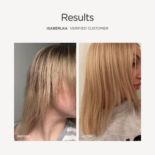 Miniatura 5 de JSHealth Vitaminas Fórmula para el Cabello y Energía - Suplemento de Apoyo para el Cabello y el Cuero Cabelludo con Yodo y Zinc - 30 Cápsulas