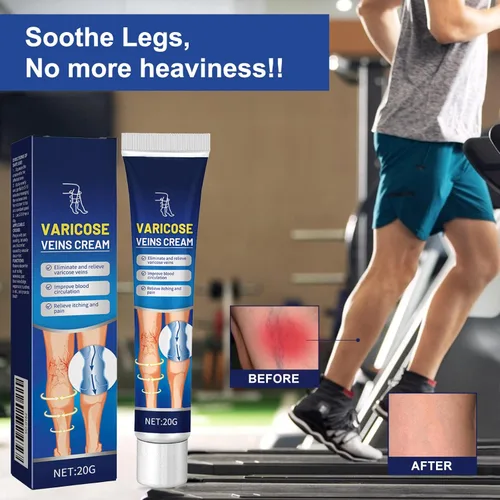 Miniatura 2 de Crema para venas varicosas para piernas, pies y tobillos, crema para el cuidado del edema, mejora la apariencia de la piel y las molestias, alivia