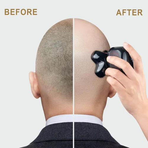 Miniatura 4 de Telfun Afeitadora desmontable del pelo de la cabeza y del cuerpo, maquinilla de afeitar eléctrica magnética para el afeitado rápido Azul