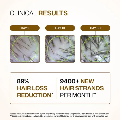 Miniatura 3 de Bare Anatomy Suero avanzado de densidad capilar 3% redensyl, 4% anagain, 3% baicapil, 1% capilia longa, romero, biotina y extracto de arroz