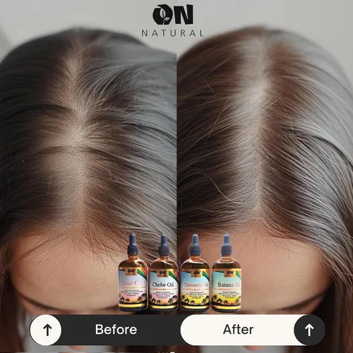 Miniatura 8 de On Natural Aceite de batana para mejorar el cabello y el cuero cabelludo