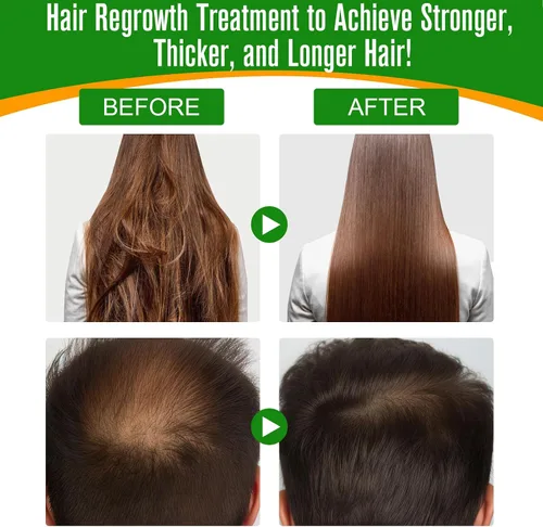 Miniatura 9 de Paquete de 3 aceites de batana para el crecimiento del cabello, puro y natural para cabello dañado, hidratación y reparación de cuidado de la piel