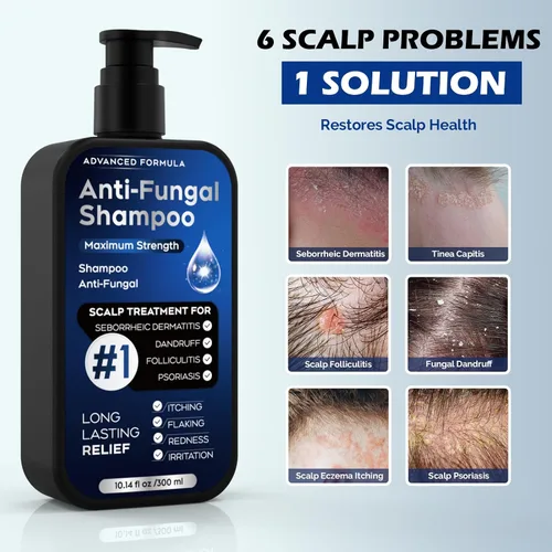 Miniatura 2 de Champú antifúngico para dermatitis seborreica, foliculitis y psoriasis del cuero cabelludo, champú anticaspa para hombres y mujeres, alivia