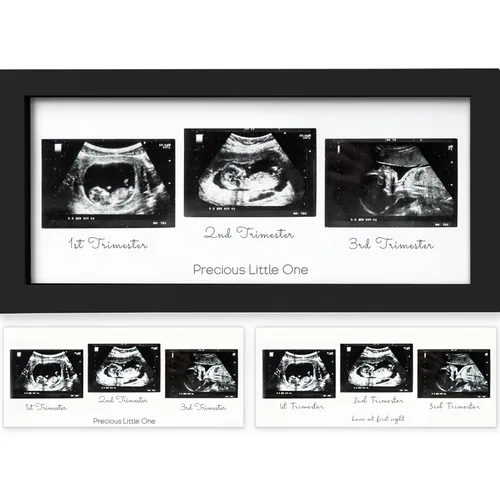 Miniatura 17 de KeaBabies Marco de Fotos de Ecografía para Bebé - Marcos Modernos de Fotos de Ultrasonido para Futuras Mamás, Regalos de Primer Embarazo para Mamá