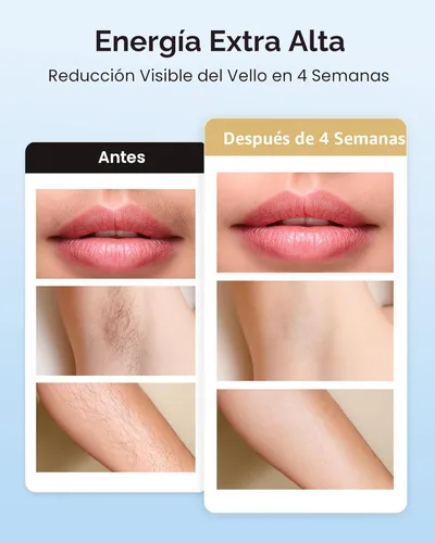Miniatura 3 de INNZA Depilación láser con función de cuidado de enfriamiento por hielo para mujeres, permanente, 999,999 destellos sin dolor IPL, dispositivo