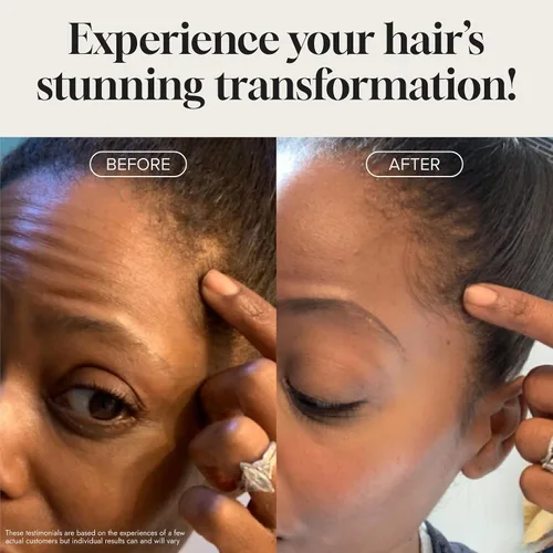 Miniatura 4 de Suero para el crecimiento del cabello Biotin, fórmula tópica avanzada para ayudar a crecer un cabello saludable y fuerte, adecuado para hombres