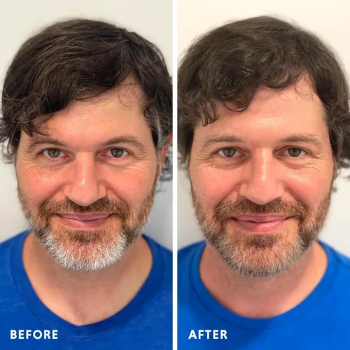 Miniatura 6 de Color de cabello y barba para mezclar grises, paquete de 2 unidades, marrón oscuro, sin amoníaco, kit completo de tinte para barba y cabello