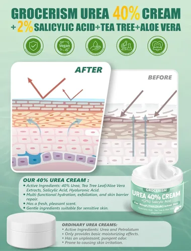 Miniatura 8 de Grocerism Crema de urea 40 por ciento para pies más 2% ácido salicílico 5.29 onzas Crema de pies y manos de máxima fuerza con ácido hialurónico