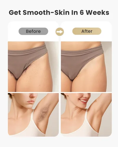 Miniatura 5 de Dispositivo de depilación IPL para mujeres y hombres, uso en el hogar Dispositivo personal Depilación para cuerpo, para uso personal, gafas Blanco