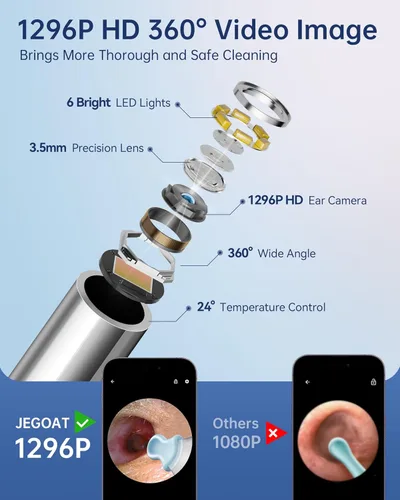 Miniatura 4 de Cámara con herramienta de eliminación de cera de oído, limpiador de oídos con cámara, kit de limpieza de oídos 1296P HD, 6 luces LED y 11 púas