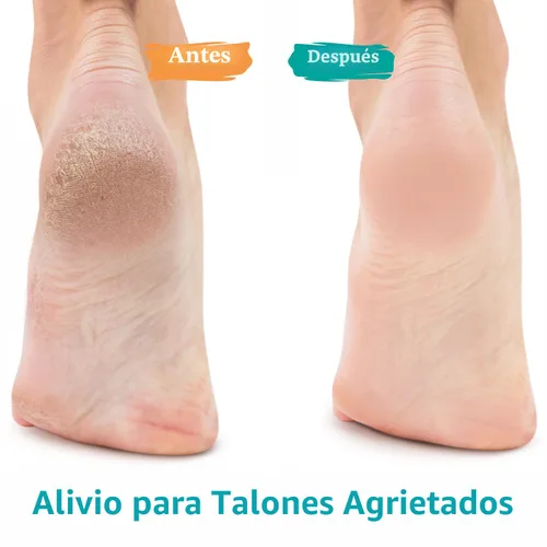 Miniatura 2 de GILDEN TREE Gel de urea 42 % para pies, máxima fuerza, suaviza los callos del talón agrietado y las uñas gruesas de los pies
