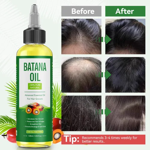 Miniatura 4 de ZIIDII Aceite de batana para el crecimiento del cabello, aceite de batana orgánico sin refinar Dr. Sebi de Honduras, puro y natural, promueve