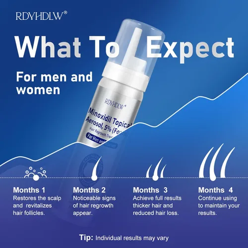 Miniatura 6 de Espuma de minoxidil al 5% para hombres y mujeres, crecimiento del cabello, espuma de minoxidil para hombres para cabello y barba, tratamiento