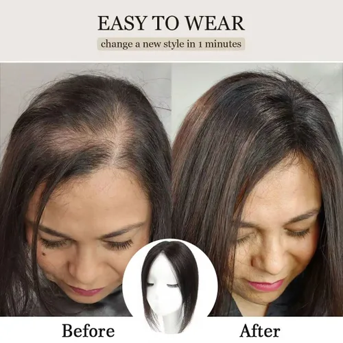 Miniatura 5 de Aimeolyn Toppers de cabello para mujer, cabello humano real, sin flequillo, extensiones de cabello superior para adelgazar, base de encaje Haisr
