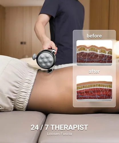 Miniatura 3 de HYAKO Masajeador Pro Max Therapy – Vibración de tejido profundo profesional de 6500 RPM para aliviar el dolor de cuerpo completo y liberación