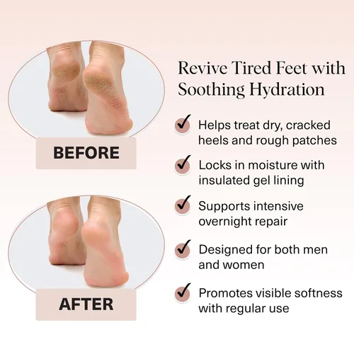 Miniatura 3 de Kitsch - Calcetines hidratantes para tratamiento de talones agrietados – Calcetines de spa reutilizables para mujeres y hombres con forro de gel