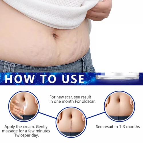 Miniatura 5 de Gel avanzado para cicatrices quirúrgicas, cara, cuerpo, piernas, quemaduras, acné, cesárea, estrías, queloides, eliminación eficaz de cicatrices