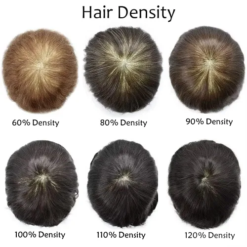 Miniatura 5 de Toupee - Sistema de reemplazo de cabello humano real de 0.004 in para hombres, con inyección, poliuretano duradero, piel fina, línea capilar