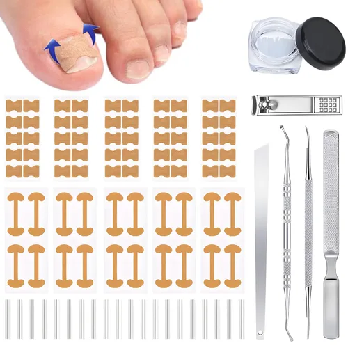 Juego de corrector de uñas encarnadas con tiras correctoras, juego profesional de herramientas de pedicura para uñas encarnadas para hombres y